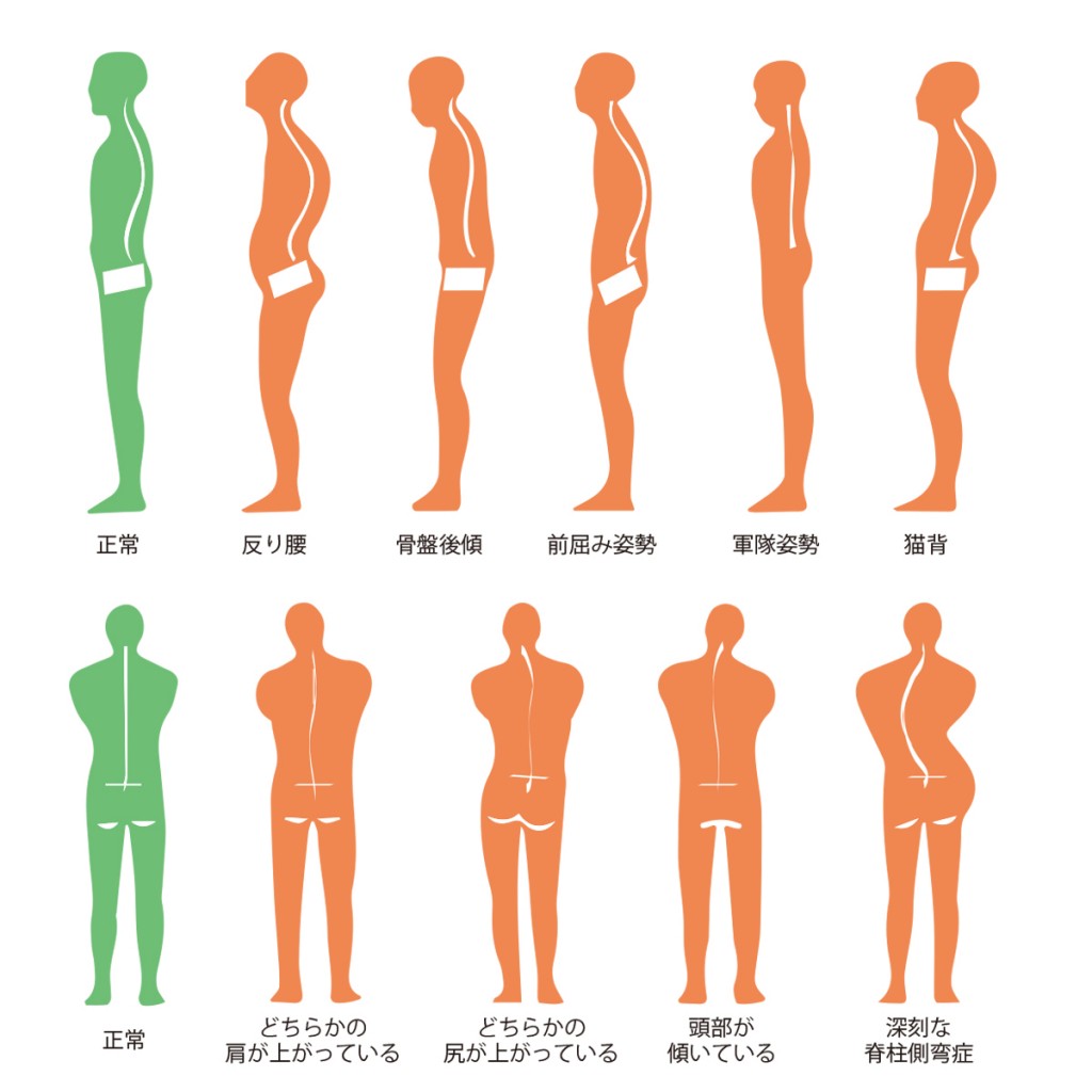 姿勢のパターン