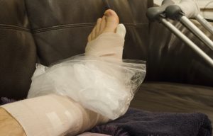 Icing Broken, Fractured or Sprained Foot or Ankle in Cast