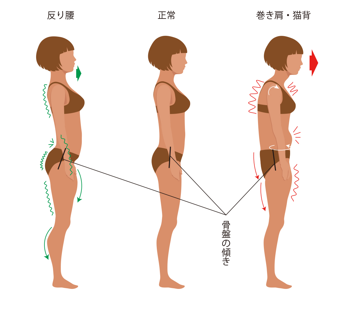 posture-3type