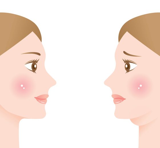 woman with double chin and beautiful slim chin. before and after