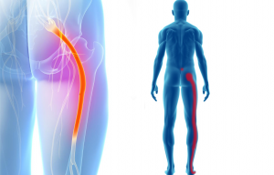 sciatica-stretches