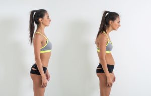 Woman with impaired posture position defect scoliosis and ideal bearing